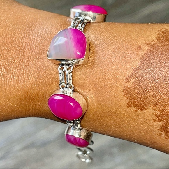 Pink Botswana Banded Agate Bracelet 6 1/2” - 7 1/2” - Picture 3 of 8